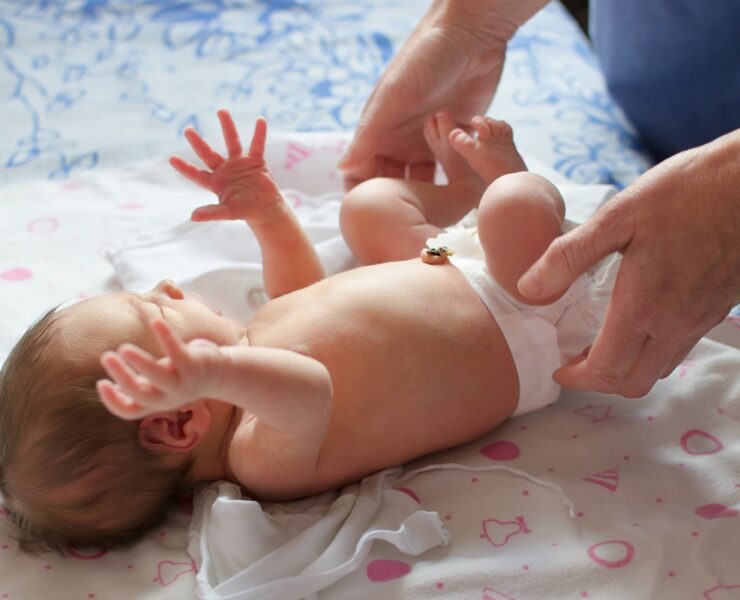 Το αντανακλαστικό Moro μπορεί να είναι εκπληκτικό για τους νέους γονείς – εδώ όλα όσα θέλετε να ξέρετε