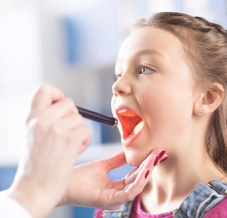 Πονόλαιμος: Ο απόλυτος οδηγός για γονείς – πώς να τον προλάβετε και να τον «νικήσετε» πριν ταλαιπωρήσει όλη την οικογένεια