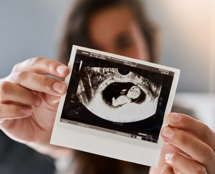 Πώς αναπτύσσονται οι 5 αισθήσεις του μωρού στη μήτρα