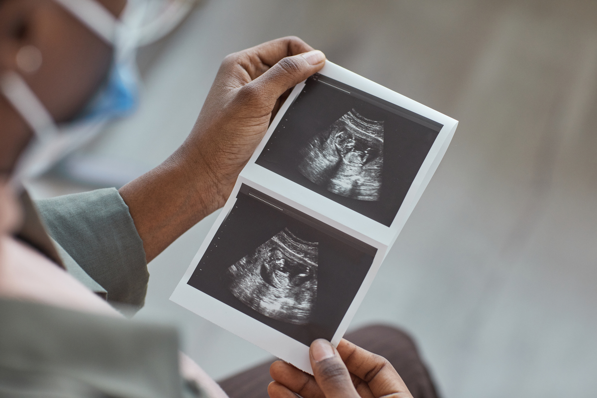 Ozempic και γονιμότητα: τι ισχύει για τα «Ozempic babies», την αντισύλληψη και την ασφάλεια πριν την εγκυμοσύνη